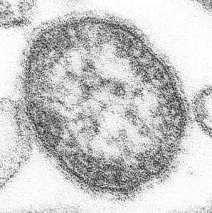 The Morbillivirus which causes “The Measles”